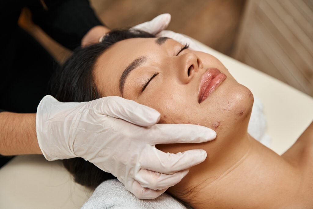 UMI Clear Skin Acne Facial 60 Min